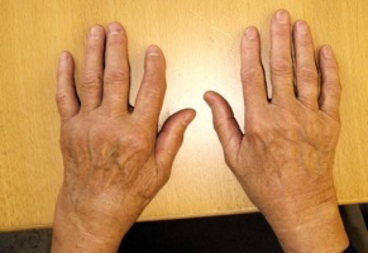 Praxissignet Dr Grüninger, Variante des orthopädenbäumchens co Moritz